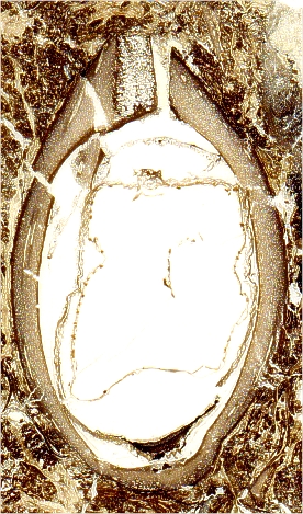 Pachytesta